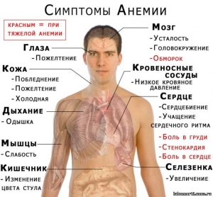 Общая информация о симптомах анемии