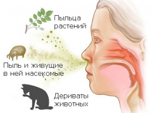 аллергический ринит
